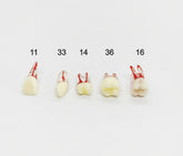 Endodontie Training Zähne