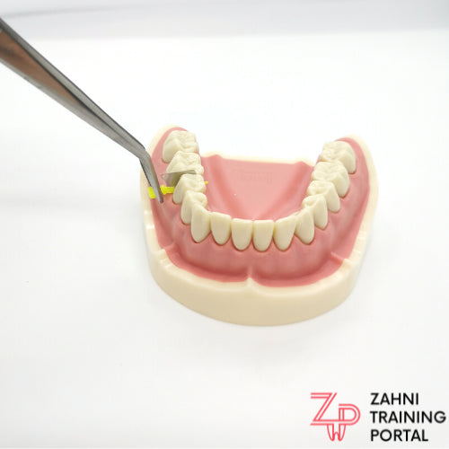 Dental Fender Wedge, Matrizen/Keil-Kombination 50er Packung